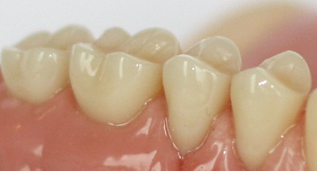 Grossaufnahme von Zähnen